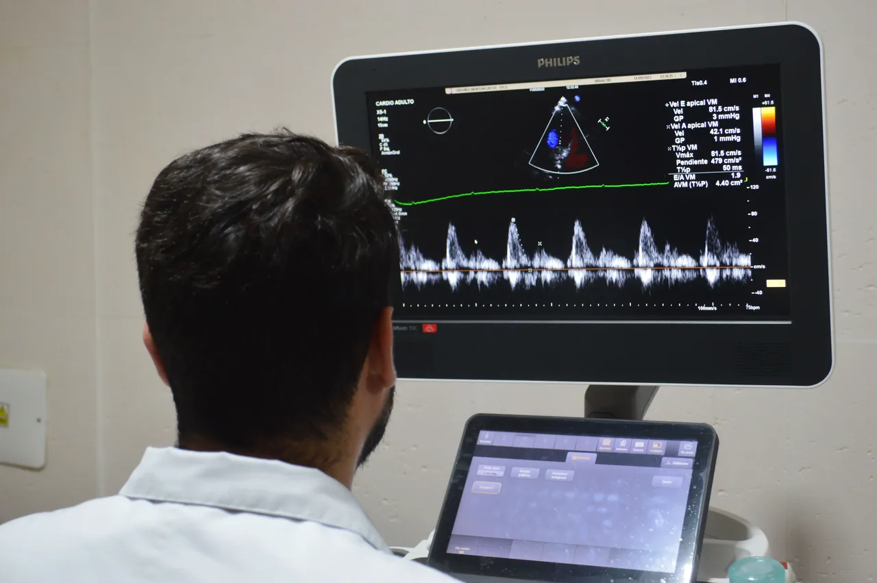 Ecocardiograma realizado por el equipo médico de Biocor